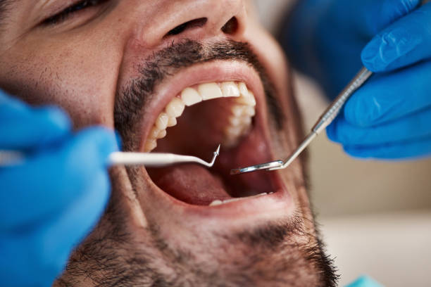 Best Emergency Gum Treatment in Burnt Mills, MD